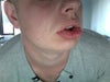 this is my lip :(
