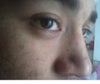 Actual nose