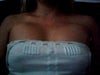 The 2nd picture is 3 days po (with a blue top on).