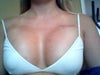 The 4th picture is 10 days po (with a white sports bra)