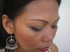 There are multiple pimple marks on both cheek and pore head