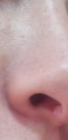 nose
