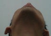 Bottom view of jaw