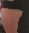 Other side view.  Yuck.