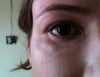 Right eye