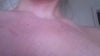 chest