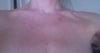 chest