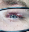Left eye open