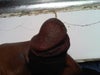 these sores are painful