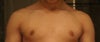 Frontal view. Here the difference in pigmentation is clear.