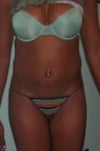 Frontal view