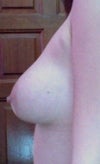 Right breast