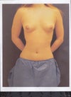 Before 1st augmentation