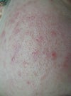 right cheek (closer)
