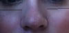 Nose now!