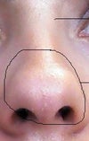 Nose Before