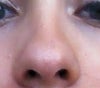 Nose Tip Before