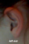 Left ear