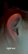 right ear