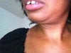 This is as far as I can close my mouth without forcing it closed.