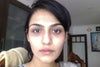 thats my skin with my bad dark circles, although the peeling isn't visible in the pic
