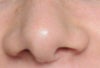 my nose from the front