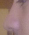 this is with the bump removed. it looks ok at this angle