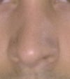 the nose looks crooked in and wavy in full face. asymetrical ,but i dont even want to talk about this ...
