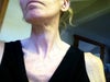 Picture of the area under my chin.  - - There should only be one picture attached showing the lower half of my face and neck.