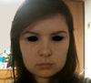 This picture is a couple of years old, but still shows the current lower face problems.