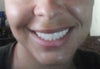 front view smiling