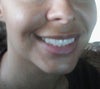 side view smiling