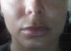 no smile