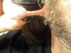 tHE THINNED ARE THAT SEEMED TO DETERIORATE