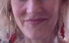 diagonal lines on cheeks...