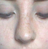 right-hand side (left in photo) visibily very swollen :(