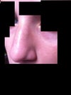Here you can see the bump from the side view. It is near the top and looks like a bean or bump