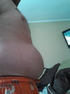 Right side of my abdomen....larger then left side.