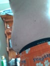 Left side of my abdomen. Smaller then right side.