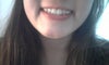 11 days post Botox (Xeomin) to masseter. This is smiling the widest.