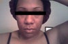 frontal view.
i have been up and down in weight but nothing to drastic(no kids) but i do fear i may have sagging facial skin