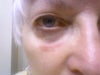 police pic post assault 2011