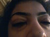 the worst day of puffiness , it is not everyday , but this day i decided to capture the nightmare