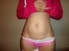 1 day before surgery