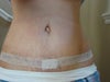 5 weeks pos op