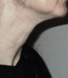 No excess skin/ flab