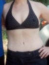 Post tuck - 6 months post abdominoplasty