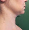 I have gained some weight--not sure if that is the problem but even at my ideal weight I have a double chin