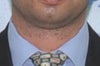 unknown neck lesions_1