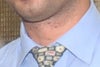 unknown neck lesions_2
